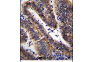 LRRN4CL Antibody (Center) (ABIN656629 and ABIN2845875) immunohistochemistry analysis in formalin fixed and paraffin embedded human uterus tissue followed by peroxidase conjugation of the secondary antibody and DAB staining. (LRRN4CL Antikörper  (AA 117-146))