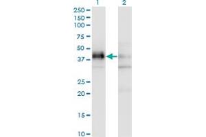 Western Blot analysis of SFRS5 expression in transfected 293T cell line by SFRS5 monoclonal antibody (M03A), clone 2C8. (SRSF5 Antikörper  (AA 1-272))