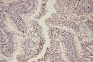 Immunohistochemical analysis of paraffin-embedded Rat Colorectal tissue using EGFR (Phospho-Thr678) Antibody.