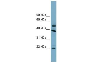 WB Suggested Anti-C4orf20 Antibody Titration: 0. (UFSP2 Antikörper  (Middle Region))