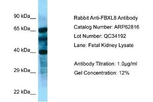 Western Blotting (WB) image for anti-F-Box and Leucine-Rich Repeat Protein 8 (FBXL8) (N-Term) antibody (ABIN2789254) (FBXL8 Antikörper  (N-Term))
