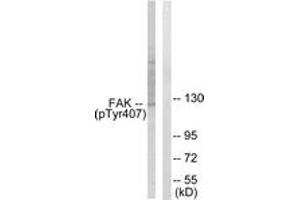 Western blot analysis of extracts from COS7 cells treated with EGF 200ng/ml 30', using FAK (Phospho-Tyr407) Antibody. (FAK Antikörper  (pTyr407))
