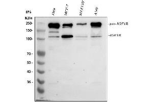Western blot analysis of IGF1R using anti-IGF1R antibody (ABIN7601749).