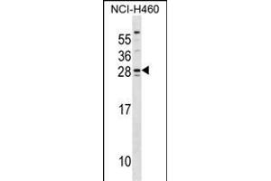SH3BGR Antibody (Center) (ABIN1537875 and ABIN2848568) western blot analysis in NCI- cell line lysates (35 μg/lane). (SH3BGR Antikörper  (AA 149-177))