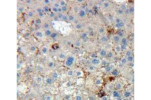 Used in DAB staining on fromalin fixed paraffin-embedded liver tissue (KIR2DL5A Antikörper  (AA 22-375))