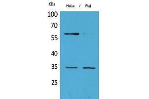 Western Blotting (WB) image for anti-Fc gamma RII (CD32) (C-Term) antibody (ABIN3178160) (Fc gamma RII (CD32) (C-Term) Antikörper)