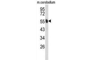 Western Blotting (WB) image for anti-Membrane Protein, Palmitoylated 6 (MAGUK P55 Subfamily Member 6) (MPP6) antibody (ABIN3004081) (MPP6 Antikörper)