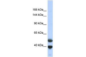 Host:  Rabbit  Target Name:  PRDM7  Sample Type:  Fetal Lung lysates  Antibody Dilution:  1. (PRDM7 Antikörper  (N-Term))