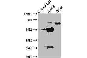 Immunoprecipitating AACS in HEK293 whole cell lysate Lane 1: Rabbit control IgG instead of ABIN7142936 in HEK293 whole cell lysate. (AACS Antikörper  (AA 435-598))