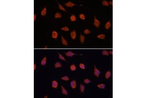 Immunofluorescence (IF) image for anti-Potassium Voltage-Gated Channel, Shaker-Related Subfamily, beta Member 2 (KCNAB2) (AA 1-40) antibody (ABIN7269481)