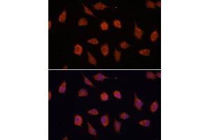 Immunofluorescence analysis of L929 cells using KCN antibody (ABIN7269481) at dilution of 1:100. (KCNAB2 Antikörper  (AA 1-40))