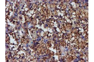 Image no. 10 for anti-Protein Disulfide Isomerase Family A, Member 4 (PDIA4) antibody (ABIN1500110)