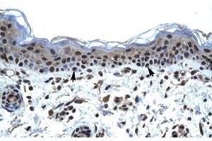 Human Skin; ZNFN1A5 antibody - N-terminal region in Human Skin cells using Immunohistochemistry (IKZF5 Antikörper  (N-Term))