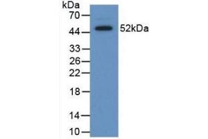 Detection of Recombinant SAP, Human using Polyclonal Antibody to Serum Amyloid P Component (SAP) (APCS Antikörper  (AA 23-223))