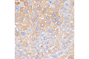 Immunohistochemistry of paraffin-embedded mouse liver using APCS antibody (ABIN3022713, ABIN3022714, ABIN3022715, ABIN1512583 and ABIN6219158) at dilution of 1:100 (40x lens). (APCS Antikörper  (AA 1-223))