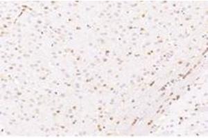 Immunohistochemistry analysis of paraffin-embedded mouse striatum using,CYPIVF11 (ABIN7073679) at dilution of 1: 12000 (CYP4F11 Antikörper)