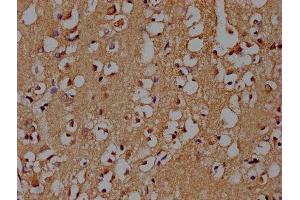 IHC image of ABIN7139719 diluted at 1:100 and staining in paraffin-embedded human brain tissue performed on a Leica BondTM system. (SNCA Antikörper  (AA 119-136))