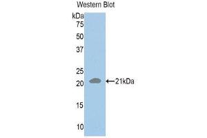 Western Blotting (WB) image for anti-RAD50 Homolog (S. Cerevisiae) (RAD50) (AA 631-793) antibody (ABIN1860394) (RAD50 Antikörper  (AA 631-793))