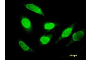 Immunofluorescence of monoclonal antibody to RUNDC2A on HeLa cell. (SNX29 Antikörper  (AA 1-249))