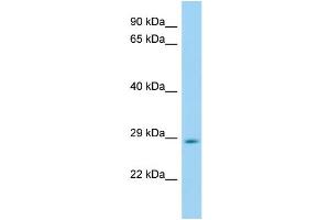 WB Suggested Anti-Hes6 Antibody Titration: 1. (HES6 Antikörper  (Middle Region))
