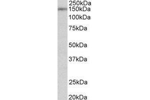 Western Blotting (WB) image for anti-Synaptic Ras GTPase Activating Protein 1 (SYNGAP1) (N-Term) antibody (ABIN2464965) (SYNGAP1 Antikörper  (N-Term))