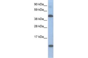Western Blotting (WB) image for anti-Ligand Dependent Nuclear Receptor Corepressor (Lcor) antibody (ABIN2461545) (Lcor Antikörper)