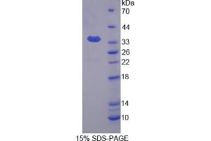 Image no. 1 for KH Domain Containing, RNA Binding, Signal Transduction Associated 1 (KHDRBS1) (AA 152-381) protein (His tag) (ABIN6238478) (KHDRBS1 Protein (AA 152-381) (His tag))