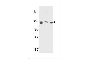 Western blot analysis of S Antibody (Center ) (Cat. (APCS Antikörper  (AA 285-314))
