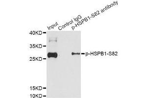 Immunoprecipitation analysis of 200 μg extracts of HeLa cells treated by EGF using 2.