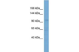 WB Suggested Anti-SLCO5A1 Antibody Titration: 0.