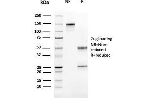 SDS-PAGE Analysis Purified Cathepsin K Mouse Monoclonal Antibody (CTSK/2791). (Cathepsin K Antikörper  (AA 163-274))