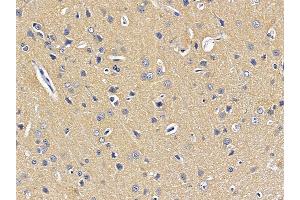anti-SCO2 Cytochrome C Oxidase Assembly Protein (SCO2) (N-Term) antibody