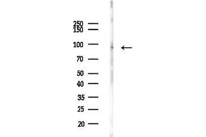 Western blot analysis of lysates from Rat liver, using Collagen IX alpha 1 Antibody at 1/1000 dilution.