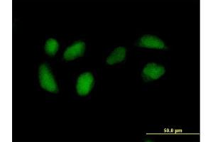 Immunofluorescence of purified MaxPab antibody to RPE on HeLa cell. (RPE Antikörper  (AA 1-228))