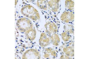 Immunohistochemistry of paraffin-embedded human stomach using FBXL5 antibody. (FBXL5 Antikörper)