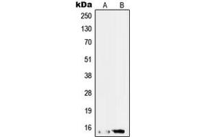 Western blot analysis of SAP14 expression in HepG2 (A), RT4 (B) whole cell lysates.