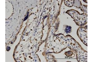 Immunostaining (ISt) image for anti-Ureidopropionase, beta (UPB1) (AA 285-384) antibody (ABIN526897)