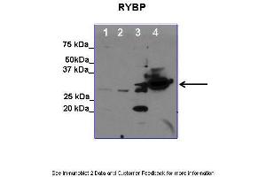 Lanes:   1. (RYBP Antikörper  (C-Term))
