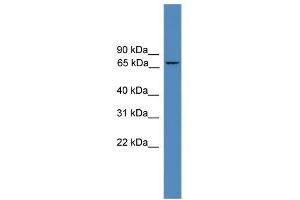 WB Suggested Anti-ZNF304 Antibody Titration: 0. (ZNF304 Antikörper  (N-Term))