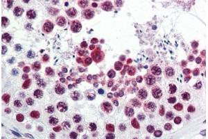 Human Testis (formalin-fixed, paraffin-embedded) stained with ATF6 antibody ABIN351434 at 5 ug/ml followed by biotinylated goat anti-rabbit IgG secondary antibody ABIN481713, alkaline phosphatase-streptavidin and chromogen. (ATF6 Antikörper  (C-Term))