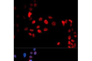 Immunofluorescence analysis of U2OS cells using Phospho-MAX(S11) Polyclonal Antibody (MAX Antikörper  (pSer11))