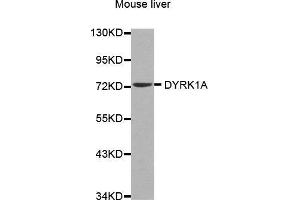 Western Blotting (WB) image for anti-Dual-Specificity tyrosine-(Y)-phosphorylation Regulated Kinase 1A (DYRK1A) (AA 624-763) antibody (ABIN6213900) (DYRK1A Antikörper  (AA 624-763))