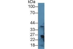 Western blot analysis of Rat Liver lysate, using Rat RGN Antibody (1 µg/ml) and HRP-conjugated Goat Anti-Rabbit antibody ( (Regucalcin Antikörper  (AA 1-299))
