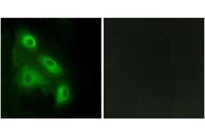 Immunofluorescence analysis of HeLa cells, using EPS8L3 Antibody. (EPS8-Like 3 Antikörper  (AA 401-450))