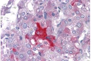 Human Adrena: Formalin-Fixed, Paraffin-Embedded (FFPE) (LMTK2 Antikörper  (AA 1181-1280))