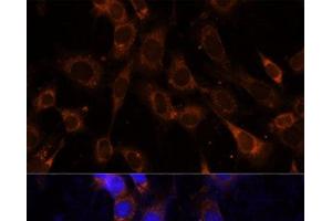 Immunofluorescence analysis of NIH-3T3 cells using VPS25 Polyclonal Antibody at dilution of 1:100 (40x lens). (VPS25 Antikörper)