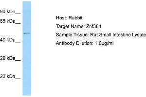 Host: Rabbit Target Name: ZNF384 Sample Tissue: Rat Small Intestine Antibody Dilution: 1ug/ml (ZNF384 Antikörper  (N-Term))