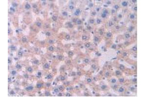 IHC-P analysis of Rat Liver Tissue, with DAB staining. (CYP1A1 Antikörper  (AA 251-521))