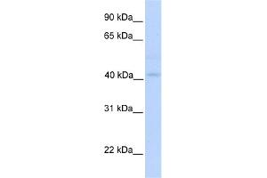 WB Suggested Anti-GSDML Antibody Titration:  0. (Gasdermin B Antikörper  (N-Term))