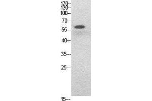 Western Blotting (WB) image for anti-Nuclear Factor-kB p65 (NFkBP65) (acLys314), (acLys315) antibody (ABIN3188030)